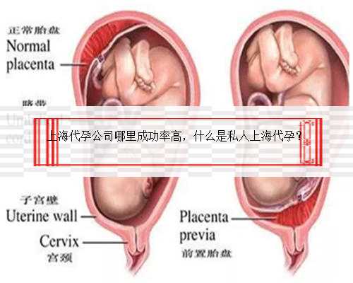 上海代孕公司哪里成功率高，什么是私人上海代孕？